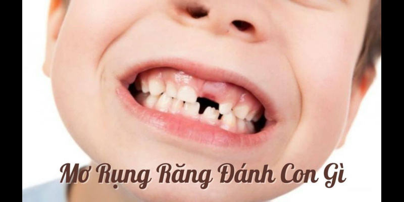 Mơ thấy gãy răng nên đánh con số gì cho phù hợp?